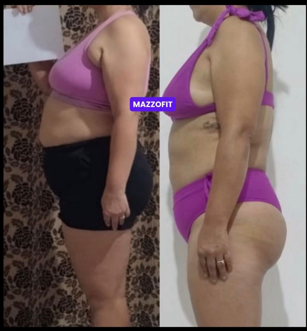 Antes e depois 1