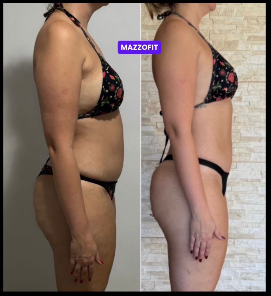 Antes e depois 3